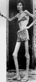 skinny babe